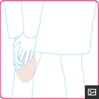 変形性膝関節症のイラスト|奈良の整体,カイロ院の山縣カイロプラクティック院